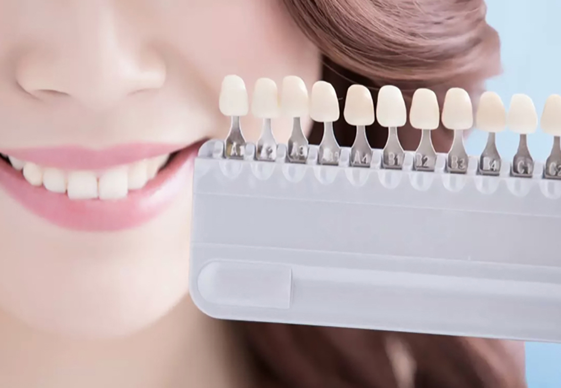 ホワイトニングの効果を宣伝する女性の口元のヘッダー画像